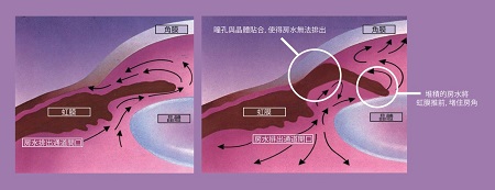 青光眼,?，斎鹨曆劭?上海眼科醫(yī)院