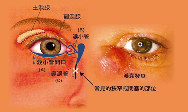 眼眶病,?，斎鹨曆劭?上海眼科醫(yī)院