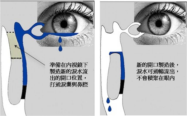 眼眶病,?，斎鹨曆劭?上海眼科醫(yī)院