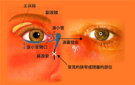 眼眶病,?，斎鹨曆劭?上海眼科醫(yī)院