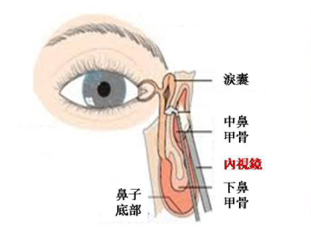眼眶病,?，斎鹨曆劭?上海眼科醫(yī)院