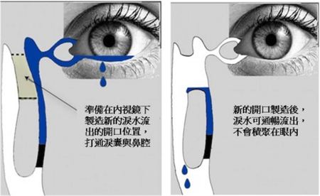眼眶病,?，斎鹨曆劭?上海眼科醫(yī)院