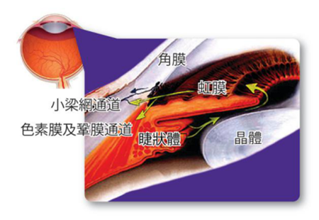 青光眼,希瑪瑞視眼科,上海眼科醫(yī)院