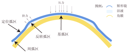 小兒眼病,?，斎鹨曆劭?上海眼科醫(yī)院