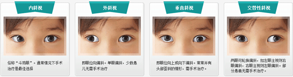 小兒眼病,?，斎鹨曆劭?上海眼科醫(yī)院