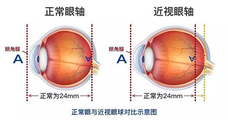 玻璃體視網(wǎng)膜,?，斎鹨曆劭?上海眼科醫(yī)院