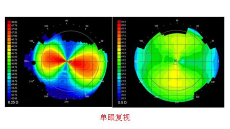 小兒眼病,?，斎鹨曆劭?上海眼科醫(yī)院