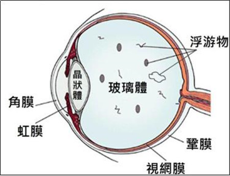 玻璃體視網(wǎng)膜,?，斎鹨曆劭?上海眼科醫(yī)院