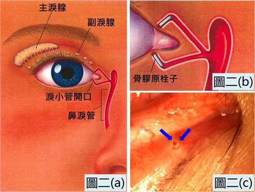 眼表眼角膜,希瑪瑞視眼科,上海眼科醫(yī)院