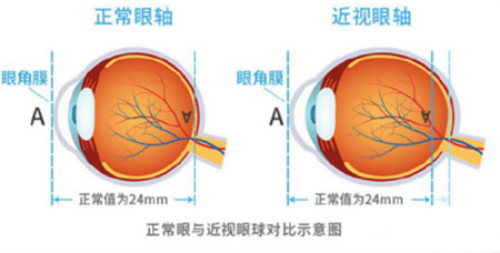 小兒眼病,?，斎鹨曆劭?上海眼科醫(yī)院