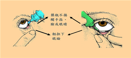眼表眼角膜,希瑪瑞視眼科,上海眼科醫(yī)院