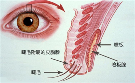 眼表眼角膜,?，斎鹨曆劭?上海眼科醫(yī)院