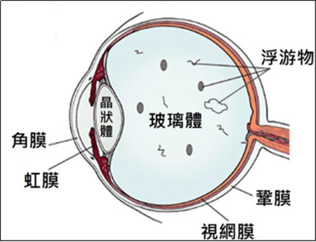 玻璃體視網(wǎng)膜,希瑪瑞視眼科,上海眼科醫(yī)院