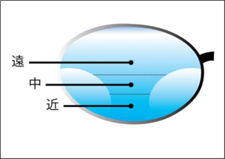 屈光矯視,?，斎鹨曆劭?上海眼科醫(yī)院