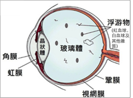 玻璃體視網(wǎng)膜,?，斎鹨曆劭?上海眼科醫(yī)院