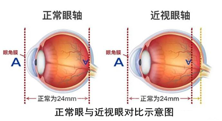 玻璃體視網(wǎng)膜,?，斎鹨曆劭?上海眼科醫(yī)院