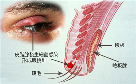 眼表眼角膜,?，斎鹨曆劭?上海眼科醫(yī)院