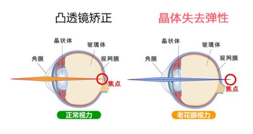 屈光矯視,?，斎鹨曆劭?上海眼科醫(yī)院